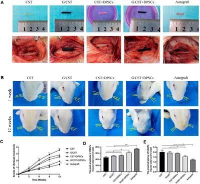 Graphene/ chitosan tubes inoculated with dental pulp stem cells promotes repair of facial nerve injury